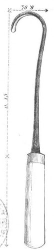 Baltet - L'art de greffer - fig9 — Line Art